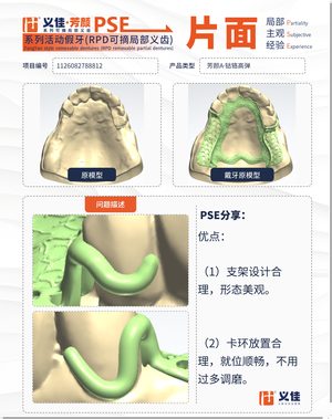 1126082788812 可摘局部义齿支架 PSE 片面记录卡案例