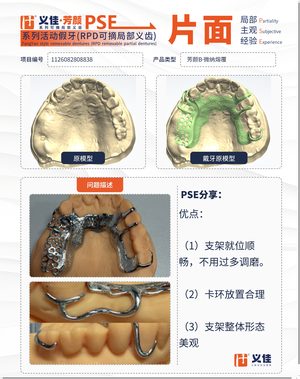 1126082808838 可摘局部义齿支架 PSE 片面记录卡案例