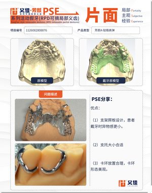 1126082808876 可摘局部义齿支架 PSE 片面记录卡案例