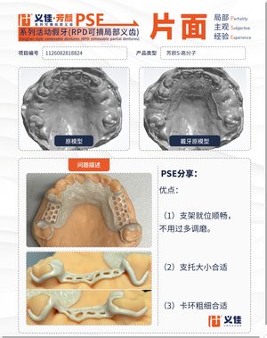 1126082818824 可摘局部义齿支架 PSE 片面记录卡案例