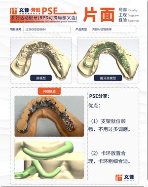1126082858864 可摘局部义齿支架 PSE 片面记录卡案例