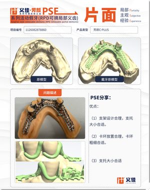 1126082878860 可摘局部义齿支架 PSE 片面记录卡案例