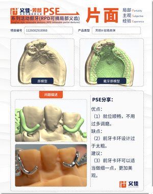 1126082918968 可摘局部义齿支架 PSE 片面记录卡案例