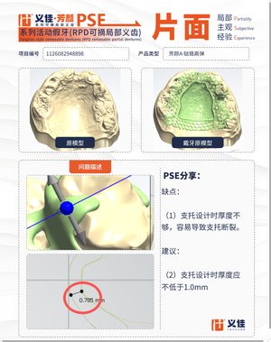 1126082948898 可摘局部义齿支架 PSE 片面记录卡案例