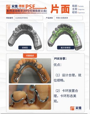 1126082978942 可摘局部义齿支架 PSE 片面记录卡案例