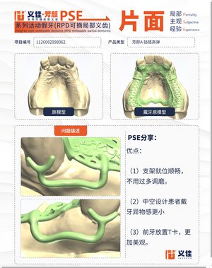 1126082998962 可摘局部义齿支架 PSE 片面记录卡案例