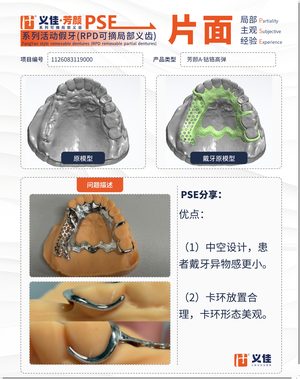 1126083119000 可摘局部义齿支架 PSE 片面记录卡案例