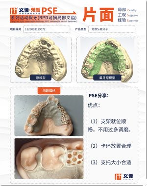 1126083129072 可摘局部义齿支架 PSE 片面记录卡案例