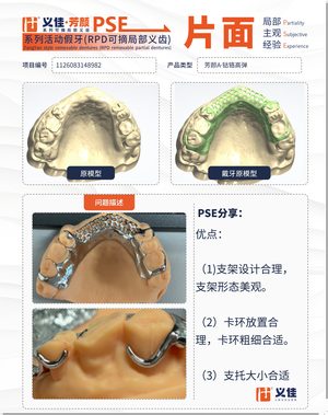 1126083148982 可摘局部义齿支架 PSE 片面记录卡案例