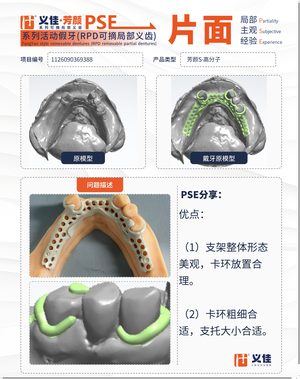 1126090369388 可摘局部义齿支架 PSE 片面记录卡案例