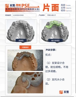 1126090419458 可摘局部义齿支架 PSE 片面记录卡案例