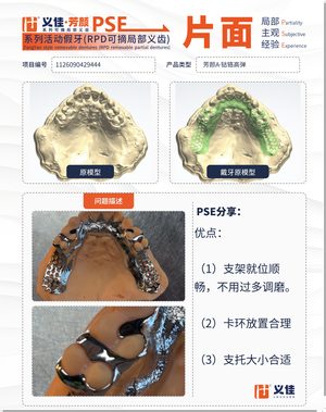 1126090429444 可摘局部义齿支架 PSE 片面记录卡案例