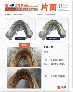 1126090449488 可摘局部义齿支架 PSE 片面记录卡案例