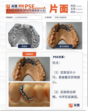 1126090539550 可摘局部义齿支架 PSE 片面记录卡案例
