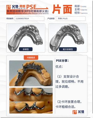 1126090579514 可摘局部义齿支架 PSE 片面记录卡案例