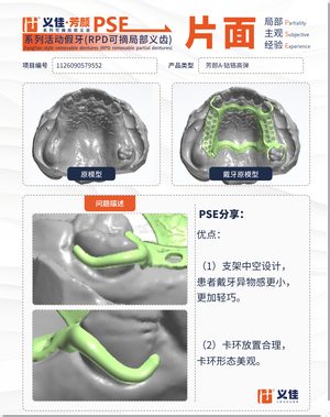 1126090579552 可摘局部义齿支架 PSE 片面记录卡案例
