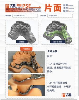 1126090749648 可摘局部义齿支架 PSE 片面记录卡案例