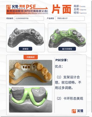 1126090809766 可摘局部义齿支架 PSE 片面记录卡案例