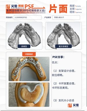 1126090829762 可摘局部义齿支架 PSE 片面记录卡案例