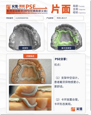 1126090849768 可摘局部义齿支架 PSE 片面记录卡案例