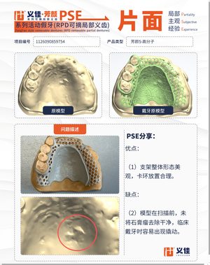 1126090859754 可摘局部义齿支架 PSE 片面记录卡案例