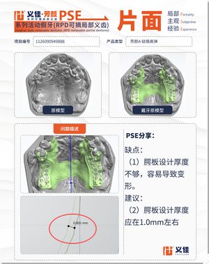 1126090949888 可摘局部义齿支架 PSE 片面记录卡案例