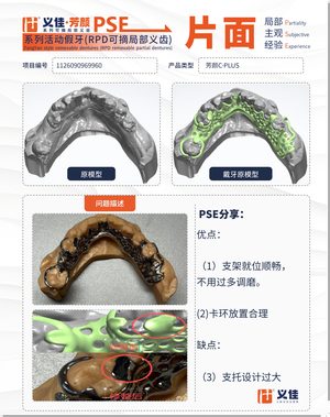 1126090969960 可摘局部义齿支架 PSE 片面记录卡案例
