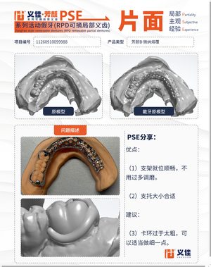 11260910099988 可摘局部义齿支架 PSE 片面记录卡案例
