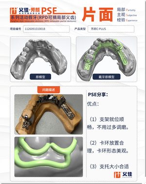 1126091010018 可摘局部义齿支架 PSE 片面记录卡案例