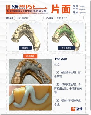 1126091080026 可摘局部义齿支架 PSE 片面记录卡案例