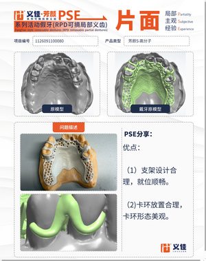 1126091100080 可摘局部义齿支架 PSE 片面记录卡案例