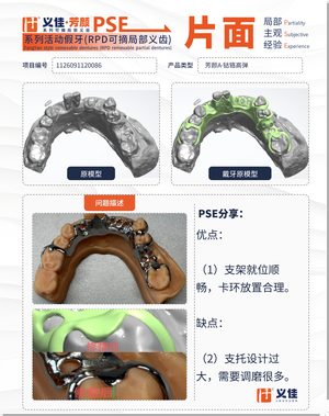 1126091120086 可摘局部义齿支架 PSE 片面记录卡案例