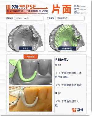 1126091190070 可摘局部义齿支架 PSE 片面记录卡案例