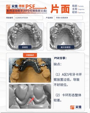 1126091470334 可摘局部义齿支架 PSE 片面记录卡案例