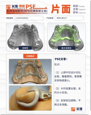 1126091680622 可摘局部义齿支架 PSE 片面记录卡案例