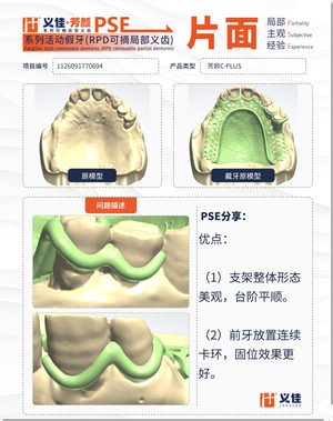 1126091770694 可摘局部义齿支架 PSE 片面记录卡案例
