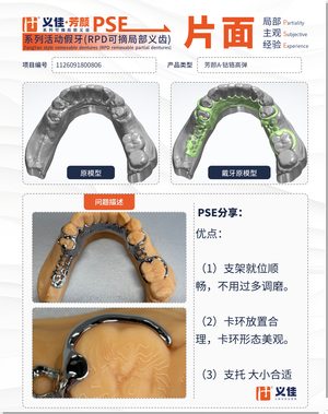 1126091800806 可摘局部义齿支架 PSE 片面记录卡案例