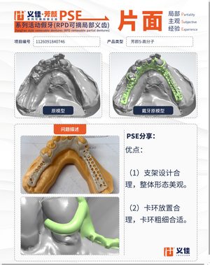 1126091840746 可摘局部义齿支架 PSE 片面记录卡案例