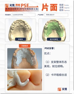 1126091870790 可摘局部义齿支架 PSE 片面记录卡案例