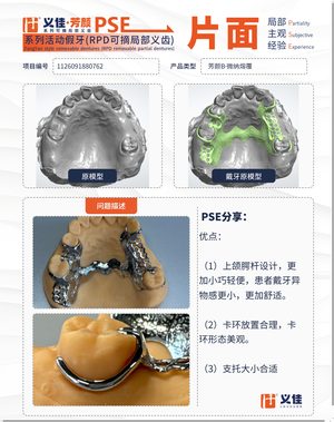 1126091880762 可摘局部义齿支架 PSE 片面记录卡案例