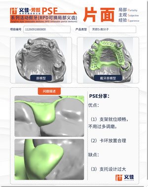 1126091880800 可摘局部义齿支架 PSE 片面记录卡案例