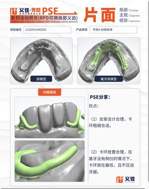1126091940828 可摘局部义齿支架 PSE 片面记录卡案例