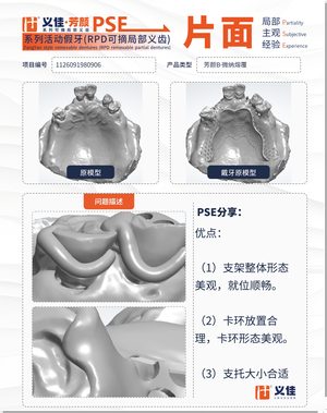 1126091980906 可摘局部义齿支架 PSE 片面记录卡案例