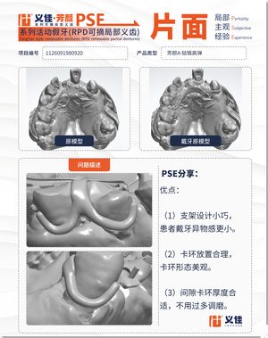 1126091980920 可摘局部义齿支架 PSE 片面记录卡案例