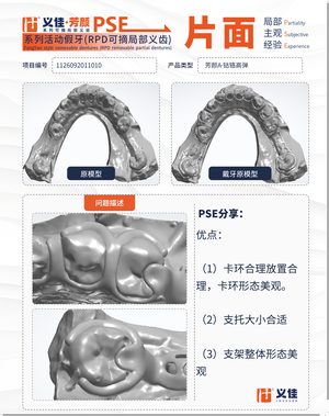 1126092011010 可摘局部义齿支架 PSE 片面记录卡案例
