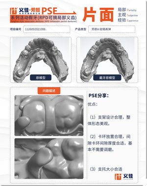 1126092021006 可摘局部义齿支架 PSE 片面记录卡案例