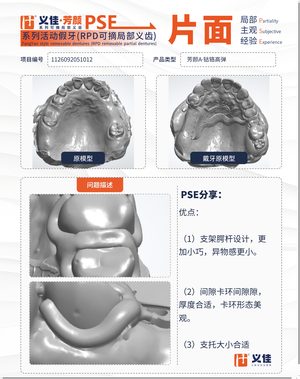 1126092051012 可摘局部义齿支架 PSE 片面记录卡案例