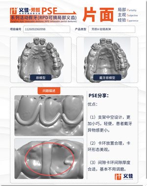1126092060998 可摘局部义齿支架 PSE 片面记录卡案例