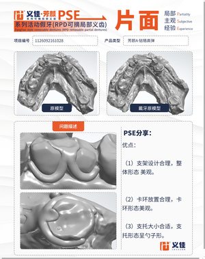1126092161028 可摘局部义齿支架 PSE 片面记录卡案例