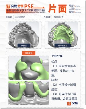 20269180047 可摘局部义齿支架 PSE 片面记录卡案例